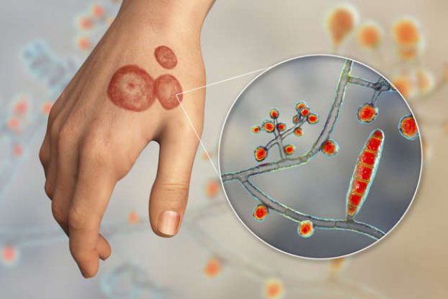 The CDC just reported the first U.S. case of a highly contagious infection